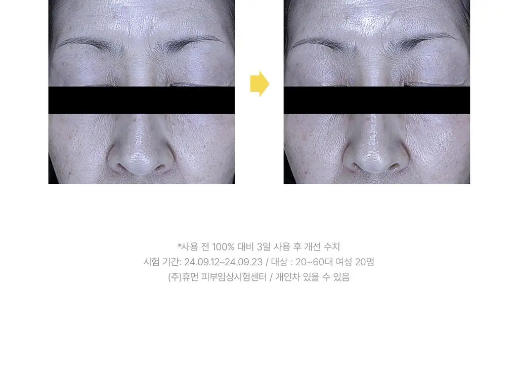 [원조겔팩] 바이오던스 리얼 딥 마스크 4매 (PDRN, 콜라겐, 세라놀, 비타, 씨켈프) 상세페이지 139